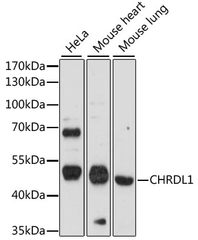 CHRDL1 Antibody - Western blot analysis of extracts of various cell lines, using CHRDL1 antibody at 1:1000 dilution. The secondary antibody used was an HRP Goat Anti-Rabbit IgG (H+L) at 1:10000 dilution. Lysates were loaded 25ug per lane and 3% nonfat dry milk in TBST was used for blocking. An ECL Kit was used for detection and the exposure time was 90s.