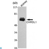 CHRDL1 Antibody - Western Blot (WB) analysis using CHRDL1 Monoclonal Antibody against Rat Kidney lysate.
