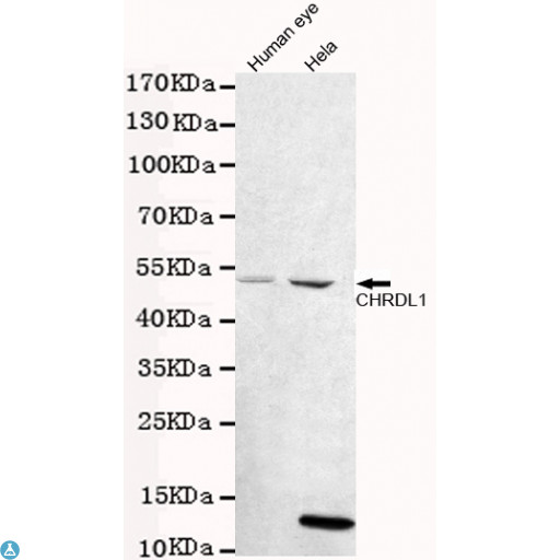 CHRDL1 Antibody - Western blot detection of CHRDL1 in human eye and Hela cell lysates using CHRDL1 mouse mAb (1:1000 diluted). Predicted band size: 57kDa. Observed band size: 52kDa.