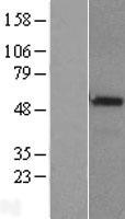 CHRDL1 Protein - Western validation with an anti-DDK antibody * L: Control HEK293 lysate R: Over-expression lysate