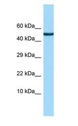 CHRDL2 Antibody - CHRDL2 antibody Western Blot of HeLa.  This image was taken for the unconjugated form of this product. Other forms have not been tested.