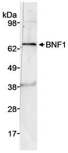 CHRDL2 Antibody - Detection of Human BNF1 by Western Blot. Sample: Whole cell lysate (50 ug) from DU145 cells. Antibody: Affinity purified rabbit anti-BNF1 antibody used at 3 ug/ml. Detection: Chemiluminescence with an exposure time of 1 minute.