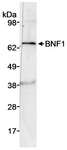 CHRDL2 Antibody - Detection of Human BNF1 by Western Blot. Sample: Whole cell lysate (50 ug) from DU145 cells. Antibody: Affinity purified rabbit anti-BNF1 antibody used at 3 ug/ml. Detection: Chemiluminescence with an exposure time of 1 minute.
