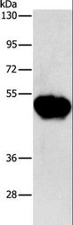 CHRDL2 Antibody - Western blot analysis of Human fetal brain tissue, using CHRDL2 Polyclonal Antibody at dilution of 1:600.