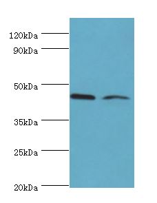 CHRFAM7A Antibody - Western blot. All lanes: CHRFAM7A antibody at 3 ug/ml. Lane 1: Jurkat whole cell lysate. Lane 2: Rat liver tissue. Secondary antibody: Goat polyclonal to rabbit at 1:10000 dilution. Predicted band size: 46 kDa. Observed band size: 46 kDa.