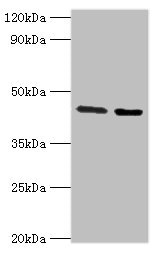 CHRFAM7A Antibody - Western blot All lanes: CHRFAM7A antibody at 3µg/ml Lane 1: Jurkat whole cell lysate Lane 2: Rat liver tissue Secondary Goat polyclonal to rabbit IgG at 1/10000 dilution Predicted band size: 46 kDa Observed band size: 46 kDa