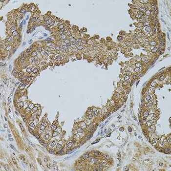 CHRFAM7A Antibody - Immunohistochemistry of paraffin-embedded human prostate tissue.
