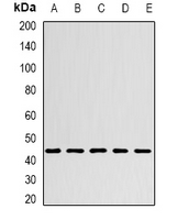 CHRFAM7A Antibody - Western blot analysis of CHRFAM7A expression in A549 (A); Jurkat (B); NIH3T3 (C); mouse brain (D); rat brain (E) whole cell lysates.