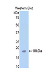 CHRM1 / M1 Antibody - Western blot of recombinant CHRM1 / M1.  This image was taken for the unconjugated form of this product. Other forms have not been tested.