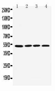 CHRM1 / M1 Antibody - Western blot analysis of CHRM1 using anti-CHRM1 antibody. Electrophoresis was performed on a 5-20% SDS-PAGE gel at 70V (Stacking gel) / 90V (Resolving gel) for 2-3 hours. The sample well of each lane was loaded with 50ug of sample under reducing conditions. Lane 1: U87 whole cell lysates, Lane 2: SHG whole cell lysates, Lane 3: NEURO whole cell lysates, Lane 4: HELA whole cell lysates. After Electrophoresis, proteins were transferred to a Nitrocellulose membrane at 150mA for 50-90 minutes. Blocked the membrane with 5% Non-fat Milk/ TBS for 1.5 hour at RT. The membrane was incubated with rabbit anti-CHRM1 antigen affinity purified polyclonal antibody at 0.5 µg/mL overnight at 4°C, then washed with TBS-0.1% Tween 3 times with 5 minutes each and probed with a goat anti-rabbit IgG-HRP secondary antibody at a dilution of 1:10000 for 1.5 hour at RT. The signal is developed using an Enhanced Chemiluminescent detection (ECL) kit with Tanon 5200 system. A specific band was detected for CHRM1 at approximately 51KD. The expected band size for CHRM1 is at 51KD.