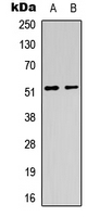 CHRM1 / M1 Antibody - Western blot analysis of CHRM1 expression in HeLa (A); mouse brain (B) whole cell lysates.