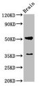 CHRM1 / M1 Antibody - Western Blot Positive WB detected in: Rat brain tissue All lanes: Chrm1 antibody at 5.5µg/ml Secondary Goat polyclonal to rabbit IgG at 1/50000 dilution Predicted band size: 52 kDa Observed band size: 52 kDa