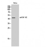 CHRM2 / M2 Antibody - Western blot of mAChR M2 antibody