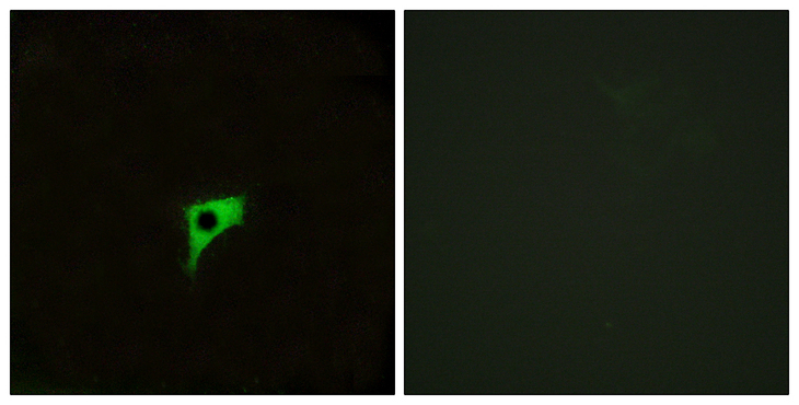 CHRM2 / M2 Antibody - Immunofluorescence analysis of LOVO cells, using CHRM2 Antibody. The picture on the right is blocked with the synthesized peptide.