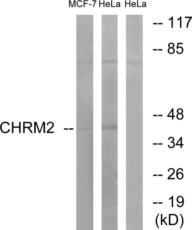 CHRM2 / M2 Antibody - Western blot analysis of lysates from HeLa and MCF-7 cells, using CHRM2 Antibody. The lane on the right is blocked with the synthesized peptide.