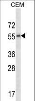 CHRM2 / M2 Antibody - CHRM2 Antibody western blot of CEM cell line lysates (35 ug/lane). The CHRM2 antibody detected the CHRM2 protein (arrow).