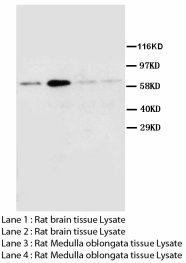 CHRM2 / M2 Antibody -  This image was taken for the unconjugated form of this product. Other forms have not been tested.