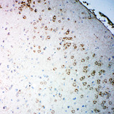 CHRM2 / M2 Antibody - CHRM2 / M2 antibody. IHC(P): Rat Brain Tissue.