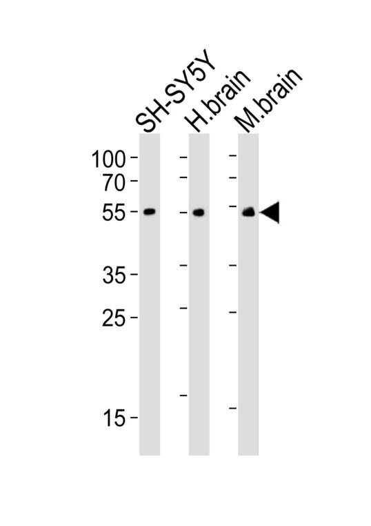 CHRM2 / M2 Antibody - Western blot of lysates from SH-SY5Y cell line, human brain, mouse brain tissue (from left to right), using CHRM2 antibody diluted at 1:500 at each lane. A goat anti-mouse IgG H&L (HRP) at 1:3000 dilution was used as the secondary antibody. Lysates at 20 ug per lane.