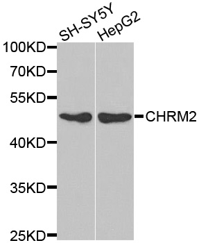 CHRM2 / M2 Antibody - Western blot analysis of extracts of various cell lines, using CHRM2 antibody at 1:1000 dilution. The secondary antibody used was an HRP Goat Anti-Rabbit IgG (H+L) at 1:10000 dilution. Lysates were loaded 25ug per lane and 3% nonfat dry milk in TBST was used for blocking.