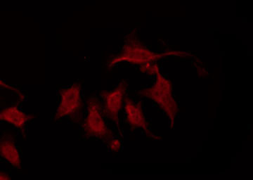 CHRM2 / M2 Antibody - Staining HeLa cells by IF/ICC. The samples were fixed with PFA and permeabilized in 0.1% Triton X-100, then blocked in 10% serum for 45 min at 25°C. The primary antibody was diluted at 1:200 and incubated with the sample for 1 hour at 37°C. An Alexa Fluor 594 conjugated goat anti-rabbit IgG (H+L) Ab, diluted at 1/600, was used as the secondary antibody.
