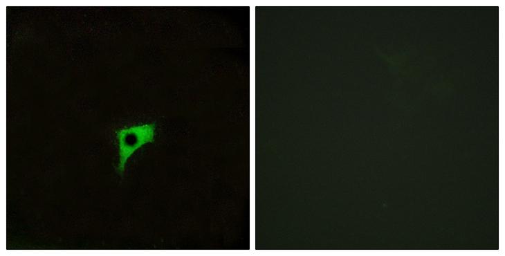 CHRM2 / M2 Antibody - Peptide - + Immunofluorescence analysis of LOVO cells, using CHRM2 antibody.