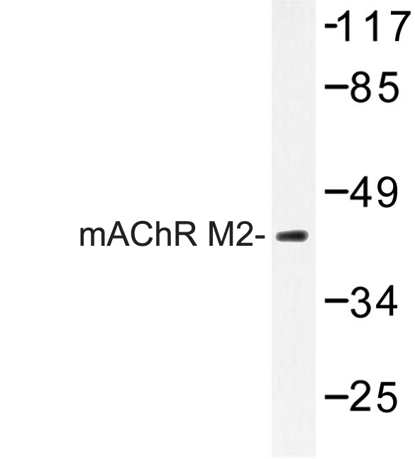 CHRM2 / M2 Antibody - Western blot of Adenosine mAChR M2 (P224) pAb in extracts from MCF-7 cells.