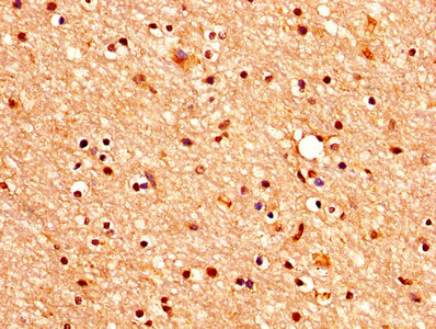 CHRM3 / M3 Antibody - IHC image of CHRM3 Antibody diluted at 1:400 and staining in paraffin-embedded human brain tissue performed on a Leica BondTM system. After dewaxing and hydration, antigen retrieval was mediated by high pressure in a citrate buffer (pH 6.0). Section was blocked with 10% normal goat serum 30min at RT. Then primary antibody (1% BSA) was incubated at 4°C overnight. The primary is detected by a biotinylated secondary antibody and visualized using an HRP conjugated SP system.