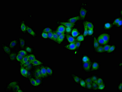 CHRM3 / M3 Antibody - Immunofluorescence staining of PC-3 cells with CHRM3 Antibody at 1:133, counter-stained with DAPI. The cells were fixed in 4% formaldehyde, permeabilized using 0.2% Triton X-100 and blocked in 10% normal Goat Serum. The cells were then incubated with the antibody overnight at 4°C. The secondary antibody was Alexa Fluor 488-congugated AffiniPure Goat Anti-Rabbit IgG(H+L).