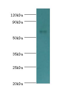 CHRM3 / M3 Antibody - Western blot. All lanes: Muscarinic acetylcholine receptor M3 antibody at 2 ug/ml+HeLa whole cell lysate. Secondary antibody: Goat polyclonal to rabbit at 1:10000 dilution. Predicted band size: 66 kDa. Observed band size: 66 kDa.