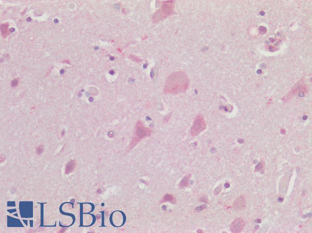 CHRM3 / M3 Antibody - Human Brain, Cortex: Formalin-Fixed, Paraffin-Embedded (FFPE)