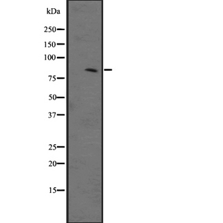 CHRM3 / M3 Antibody - Western blot analysis of CHRM3 expression in HEK293 cells. The lane on the left is treated with the antigen-specific peptide.