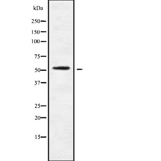 CHRM4 / M4 Antibody - Western blot analysis of mAChR M4 using K562 whole cells lysates