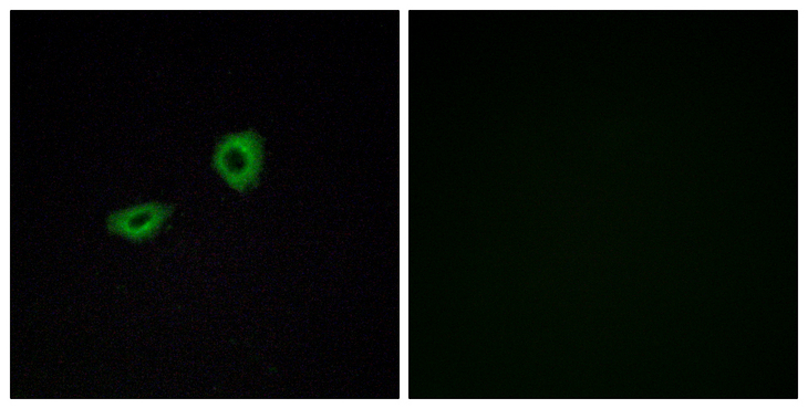 CHRM5 / M5 Antibody - Immunofluorescence analysis of A549 cells, using CHRM5 Antibody. The picture on the right is blocked with the synthesized peptide.