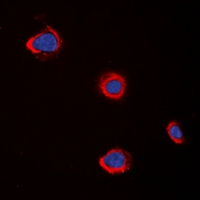 CHRM5 / M5 Antibody - Immunofluorescent analysis of CHRM5 staining in A549 cells. Formalin-fixed cells were permeabilized with 0.1% Triton X-100 in TBS for 5-10 minutes and blocked with 3% BSA-PBS for 30 minutes at room temperature. Cells were probed with the primary antibody in 3% BSA-PBS and incubated overnight at 4 deg C in a humidified chamber. Cells were washed with PBST and incubated with a DyLight 594-conjugated secondary antibody (red) in PBS at room temperature in the dark. DAPI was used to stain the cell nuclei (blue).