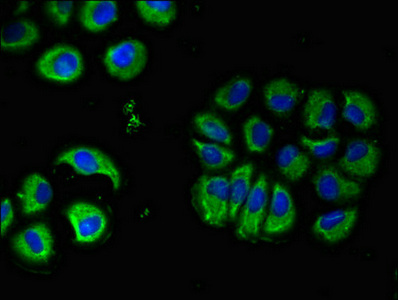 CHRM5 / M5 Antibody - Immunofluorescent analysis of A549 cells diluted at 1:100 and Alexa Fluor 488-congugated AffiniPure Goat Anti-Rabbit IgG(H+L)