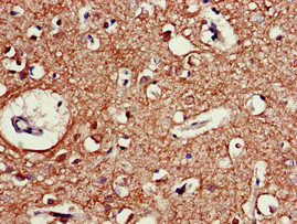 CHRM5 / M5 Antibody - Immunohistochemistry of paraffin-embedded human brain tissue at dilution of 1:100