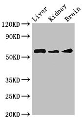 CHRM5 / M5 Antibody - Western Blot Positive WB detected in:Mouse liver tissue,Mouse kidney tissue,Mouse brain tissue All Lanes:CHRM5 antibody at 3.5µg/ml Secondary Goat polyclonal to rabbit IgG at 1/50000 dilution Predicted band size: 61 KDa Observed band size: 61 KDa