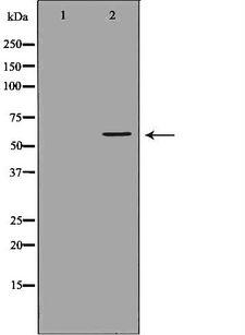 CHRM5 / M5 Antibody - Western blot analysis of mouse liver tissue lysates using CHRM5 antibody. The lane on the left is treated with the antigen-specific peptide.