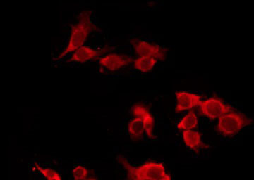 CHRM5 / M5 Antibody - Staining HeLa cells by IF/ICC. The samples were fixed with PFA and permeabilized in 0.1% Triton X-100, then blocked in 10% serum for 45 min at 25°C. The primary antibody was diluted at 1:200 and incubated with the sample for 1 hour at 37°C. An Alexa Fluor 594 conjugated goat anti-rabbit IgG (H+L) Ab, diluted at 1/600, was used as the secondary antibody.