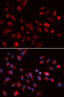 CHRM5 / M5 Antibody - Immunofluorescence analysis of U2OS cells using CHRM5 Polyclonal Antibody.