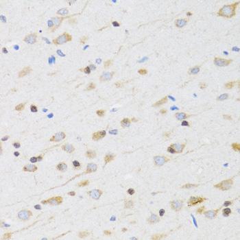 CHRM5 / M5 Antibody - Immunohistochemistry of paraffin-embedded Rat brain using CHRM5 Polyclonal Antibody at dilution of 1:100 (40x lens).