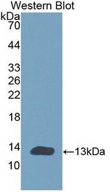 CHRNA1 Antibody - Western blot of CHRNA1 antibody.