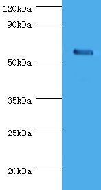 CHRNA1 Antibody - Western blot of Acetylcholine receptor subunit alpha antibody at 2 ug/ml with rat skeletal muscle.  This image was taken for the unconjugated form of this product. Other forms have not been tested.
