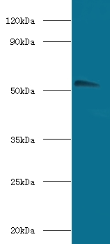 CHRNA1 Antibody - Western blot of Acetylcholine receptor subunit alpha antibody at 2 ug/ml with HeLa whole lysate secondary Goat polyclonal to rabbit at 1:10000 dilution predicted band size: 53 KDa observed band size: 53 KDa.  This image was taken for the unconjugated form of this product. Other forms have not been tested.