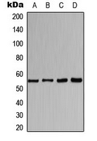 CHRNA1 Antibody - Western blot analysis of CHRNA1 expression in HeLa (A); MCF7 (B); mouse kidney (C); rat liver (D) whole cell lysates.