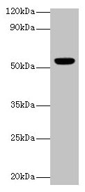 CHRNA1 Antibody - Western blot All lanes: Acetylcholine receptor subunit alpha antibody at 2µg/ml + Rat skeletal muscleSecondary Goat polyclonal to rabbit IgG at 1/10000 dilution Predicted band size: 55, 52 kDa Observed band size: 55 kDa