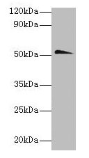 CHRNA1 Antibody - Western blot All lanes: Acetylcholine receptor subunit alpha antibody at 2µg/ml + Hela whole lysate Secondary Goat polyclonal to rabbit IgG at 1/10000 dilution Predicted band size: 53 kDa Observed band size: 53 kDa