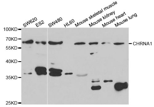 CHRNA1 Antibody - Western blot analysis of extracts of various cell lines.