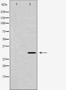 CHRNA1 Antibody - Western blot analysis of mouse heart lysate using CHRNA1 antibody. The lane on the left is treated with the antigen-specific peptide.